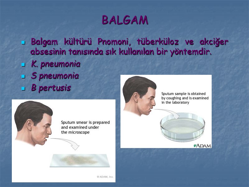 BALGAM Balgam kültürü Pnomoni, tüberküloz ve akciğer absesinin tanısında sık kullanılan bir yöntemdir. K.